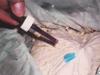 LOS NARCOTEST Y LAS ANALÍTICAS TAMBIÉN FALLAN